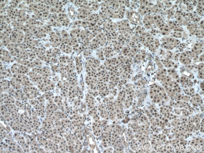 TAF1C Antibody in Immunohistochemistry (Paraffin) (IHC (P))