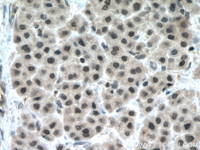 TAF1C Antibody in Immunohistochemistry (Paraffin) (IHC (P))