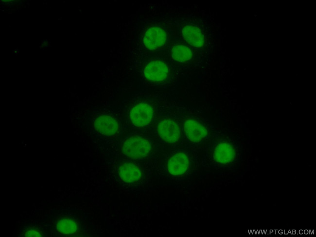 MCM6 Antibody in Immunocytochemistry (ICC/IF)