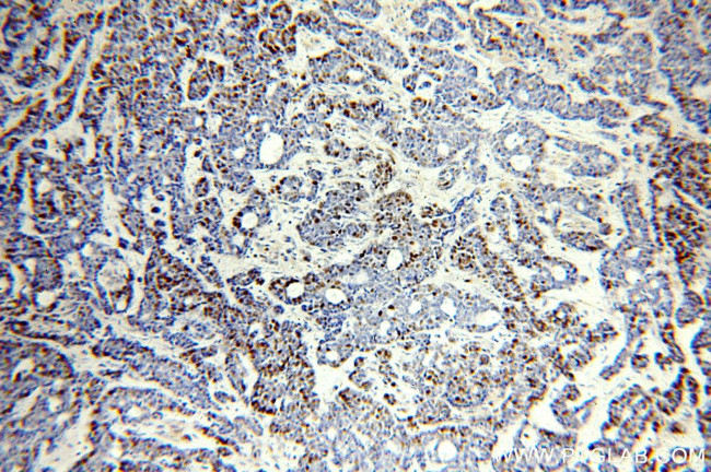 MCM6 Antibody in Immunohistochemistry (Paraffin) (IHC (P))