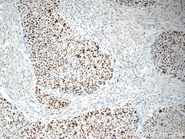 MCM6 Antibody in Immunohistochemistry (Paraffin) (IHC (P))