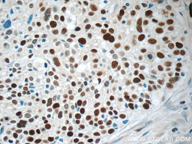 MCM6 Antibody in Immunohistochemistry (Paraffin) (IHC (P))