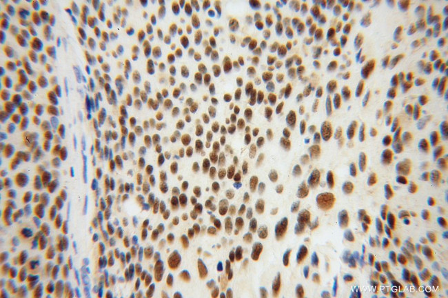 MCM6 Antibody in Immunohistochemistry (Paraffin) (IHC (P))