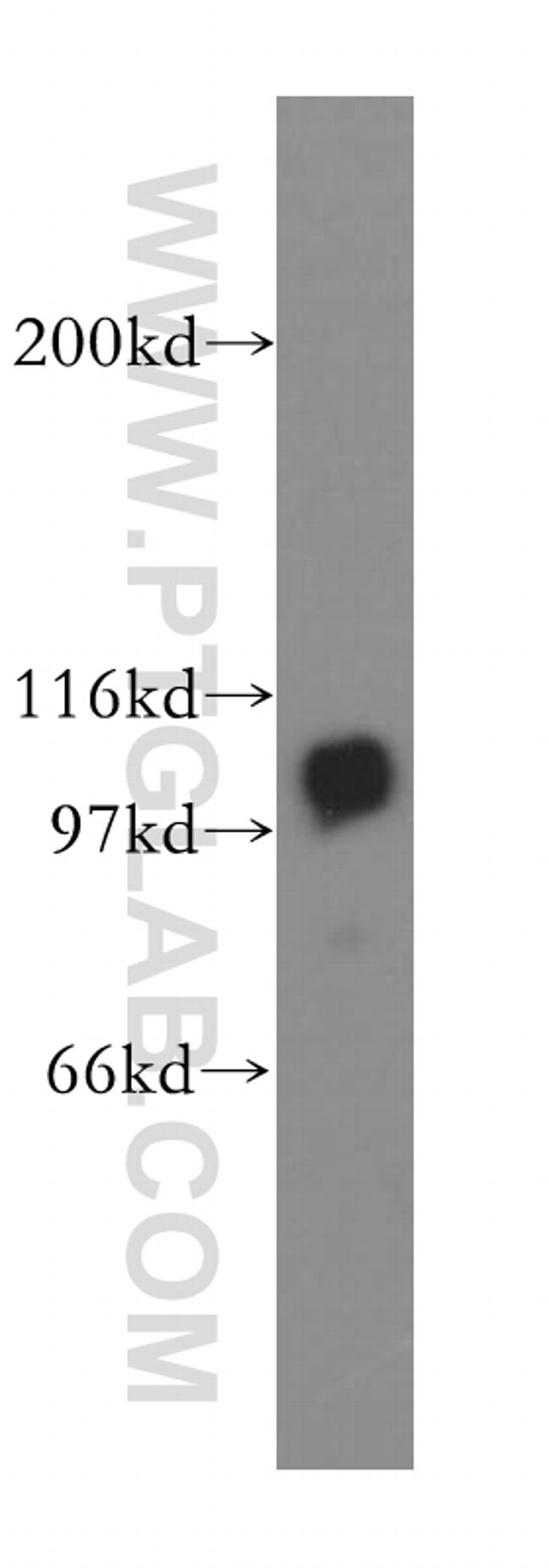 MCM6 Antibody in Western Blot (WB)