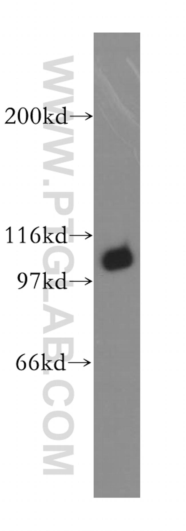 MCM6 Antibody in Western Blot (WB)