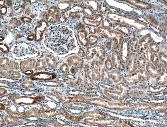 GNA14 Antibody in Immunohistochemistry (Paraffin) (IHC (P))