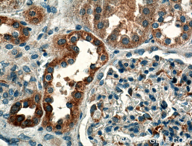 GNA14 Antibody in Immunohistochemistry (Paraffin) (IHC (P))