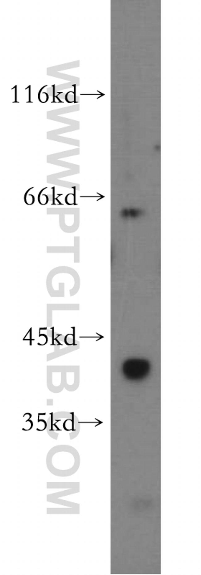 GNA14 Antibody in Western Blot (WB)