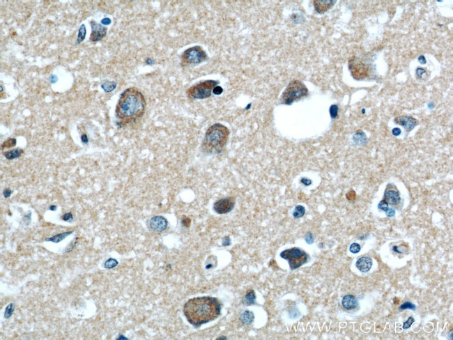 RAB39 Antibody in Immunohistochemistry (Paraffin) (IHC (P))