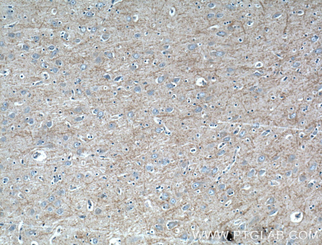 RAB39 Antibody in Immunohistochemistry (Paraffin) (IHC (P))