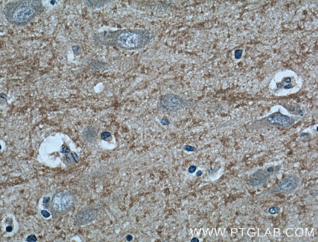 RAB39 Antibody in Immunohistochemistry (Paraffin) (IHC (P))