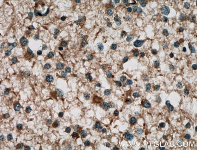 RAB39 Antibody in Immunohistochemistry (Paraffin) (IHC (P))