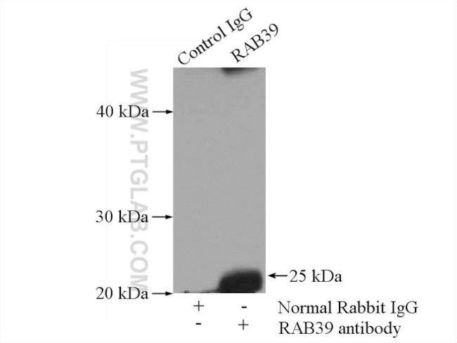 RAB39 Antibody in Immunoprecipitation (IP)