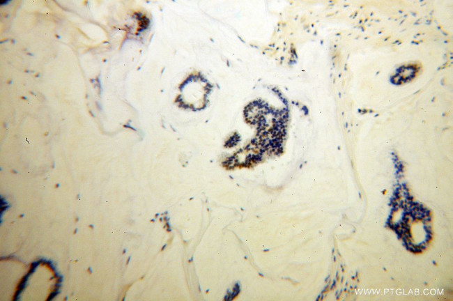 RAD17 Antibody in Immunohistochemistry (Paraffin) (IHC (P))