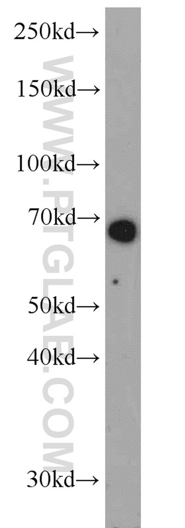 Glycerokinase Antibody in Western Blot (WB)