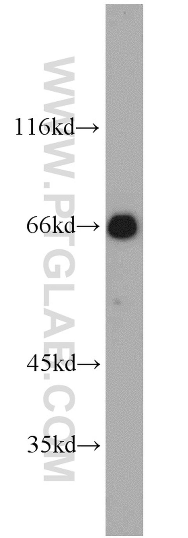 Glycerokinase Antibody in Western Blot (WB)