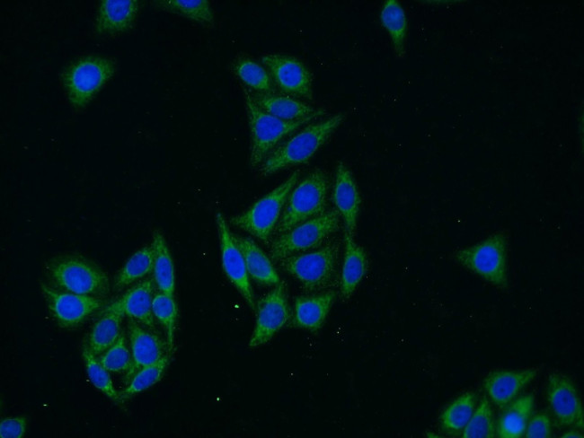 Glycerokinase Antibody in Immunocytochemistry (ICC/IF)