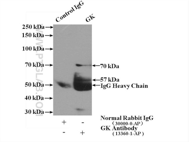 Glycerokinase Antibody in Immunoprecipitation (IP)