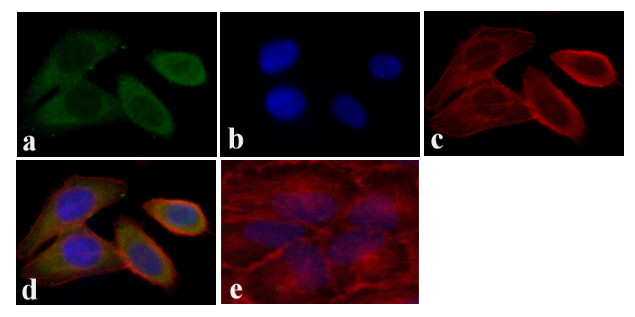 STAT5 alpha Antibody in Immunocytochemistry (ICC/IF)