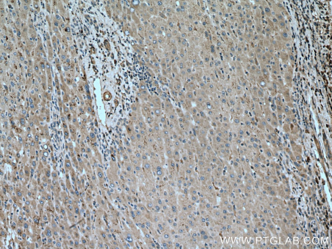 PIP5K3 Antibody in Immunohistochemistry (Paraffin) (IHC (P))