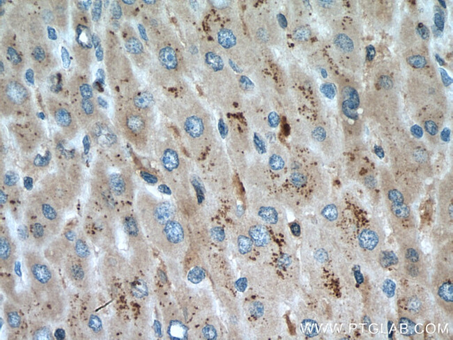 PIP5K3 Antibody in Immunohistochemistry (Paraffin) (IHC (P))