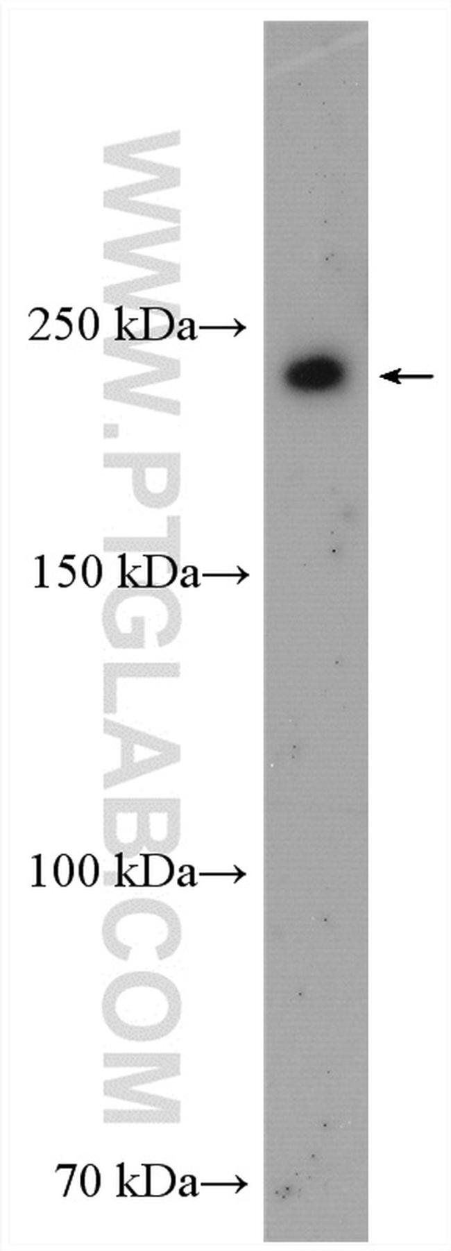 PIP5K3 Antibody in Western Blot (WB)