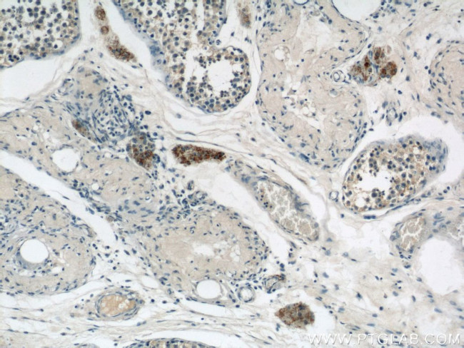 CYP11A1 Antibody in Immunohistochemistry (Paraffin) (IHC (P))