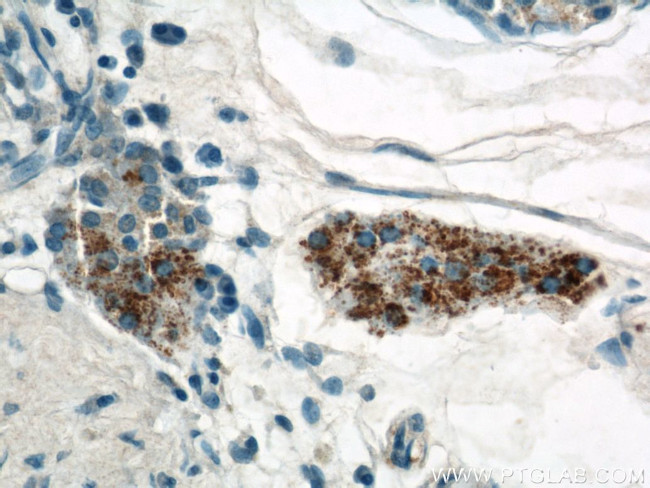 CYP11A1 Antibody in Immunohistochemistry (Paraffin) (IHC (P))