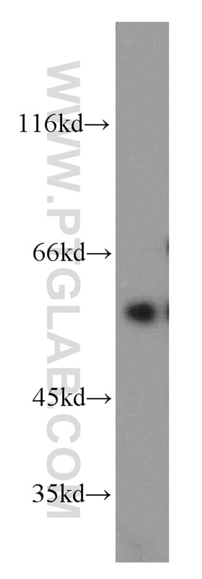 CYP11A1 Antibody in Western Blot (WB)