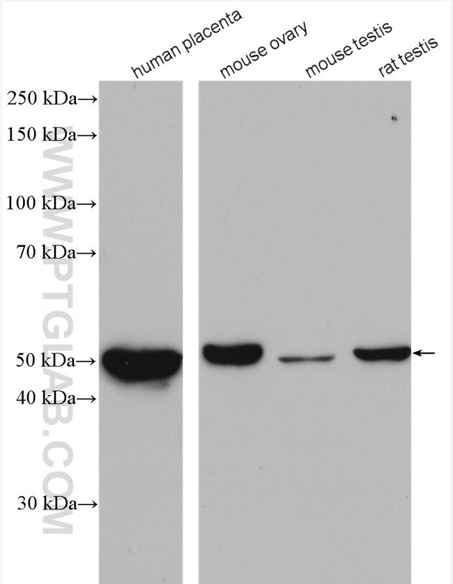 CYP11A1 Antibody in Western Blot (WB)