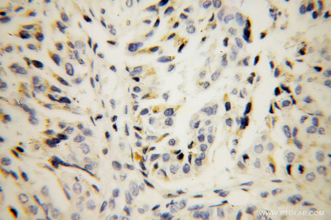 LMAN1 Antibody in Immunohistochemistry (Paraffin) (IHC (P))