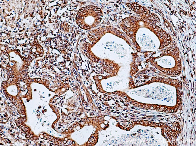 LMAN1 Antibody in Immunohistochemistry (Paraffin) (IHC (P))