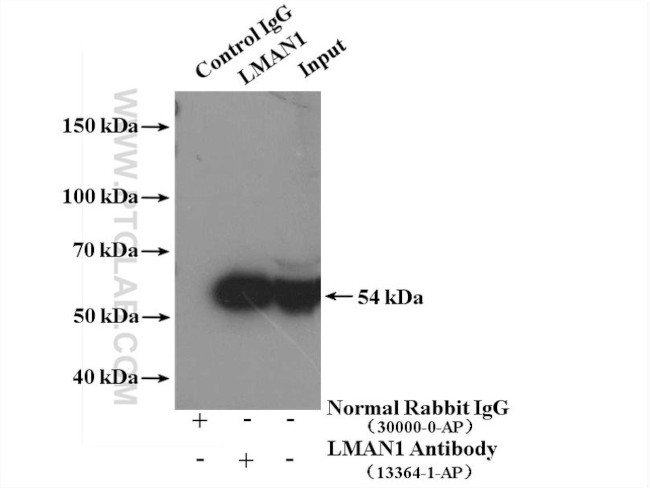 LMAN1 Antibody in Immunoprecipitation (IP)