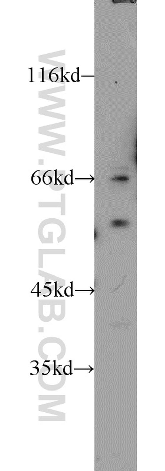 LMAN1 Antibody in Western Blot (WB)