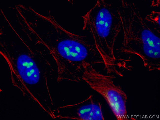 NAT10 Antibody in Immunocytochemistry (ICC/IF)