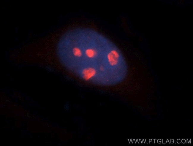 NAT10 Antibody in Immunocytochemistry (ICC/IF)