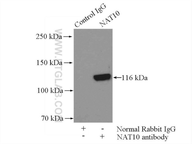 NAT10 Antibody in Immunoprecipitation (IP)