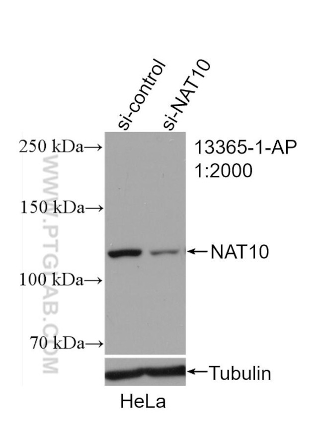 NAT10 Antibody in Western Blot (WB)