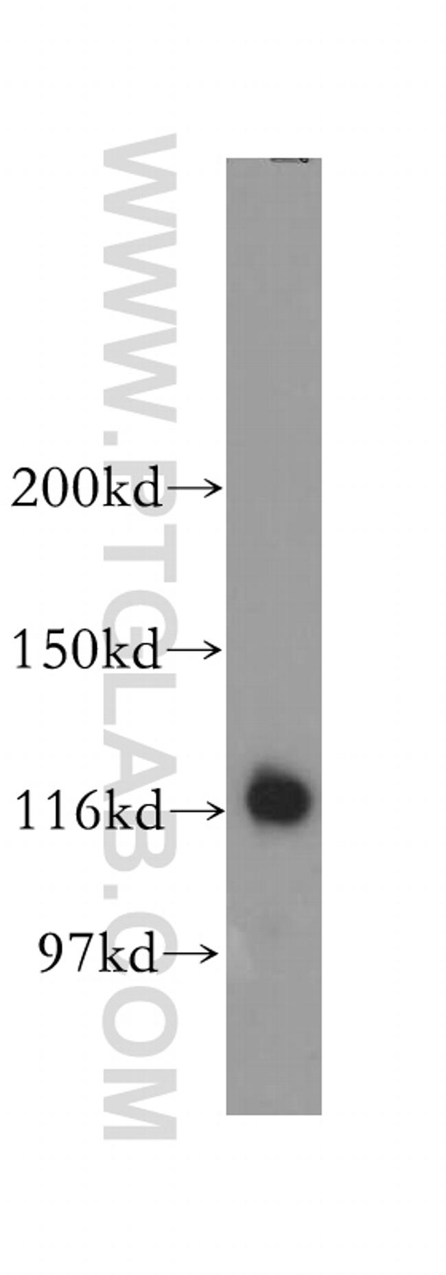 NAT10 Antibody in Western Blot (WB)