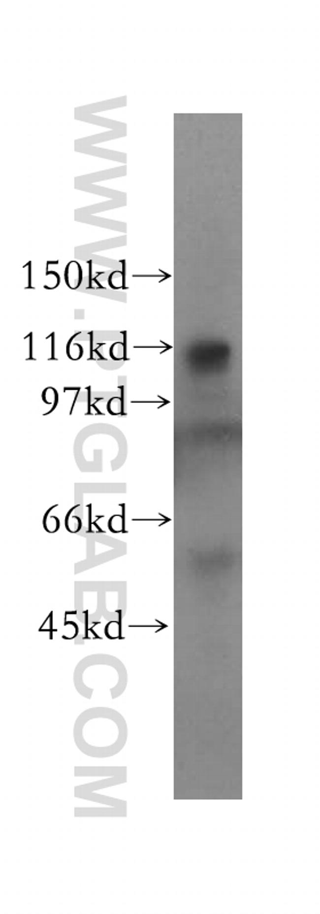 NAT10 Antibody in Western Blot (WB)