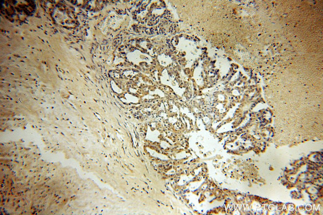 SPA17 Antibody in Immunohistochemistry (Paraffin) (IHC (P))