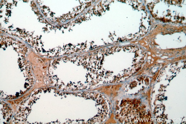 SPA17 Antibody in Immunohistochemistry (Paraffin) (IHC (P))