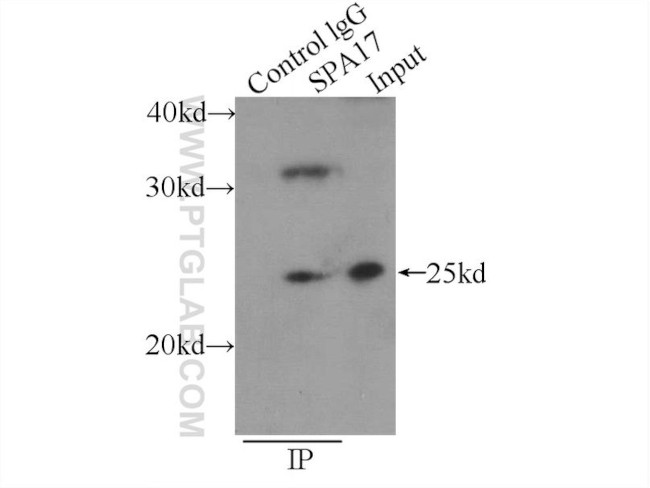 SPA17 Antibody in Immunoprecipitation (IP)