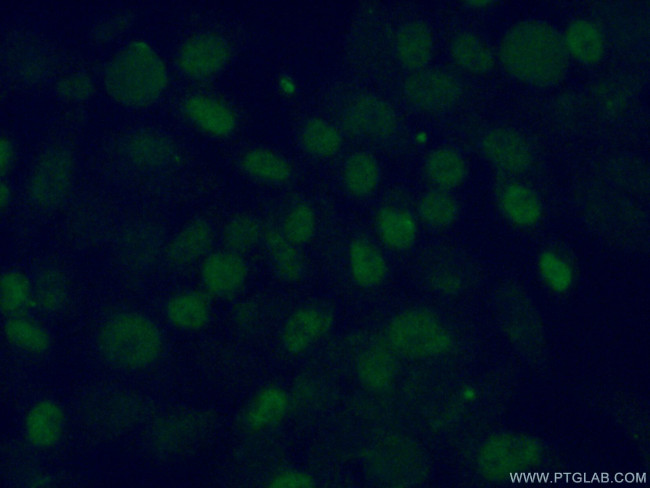 TDG Antibody in Immunocytochemistry (ICC/IF)