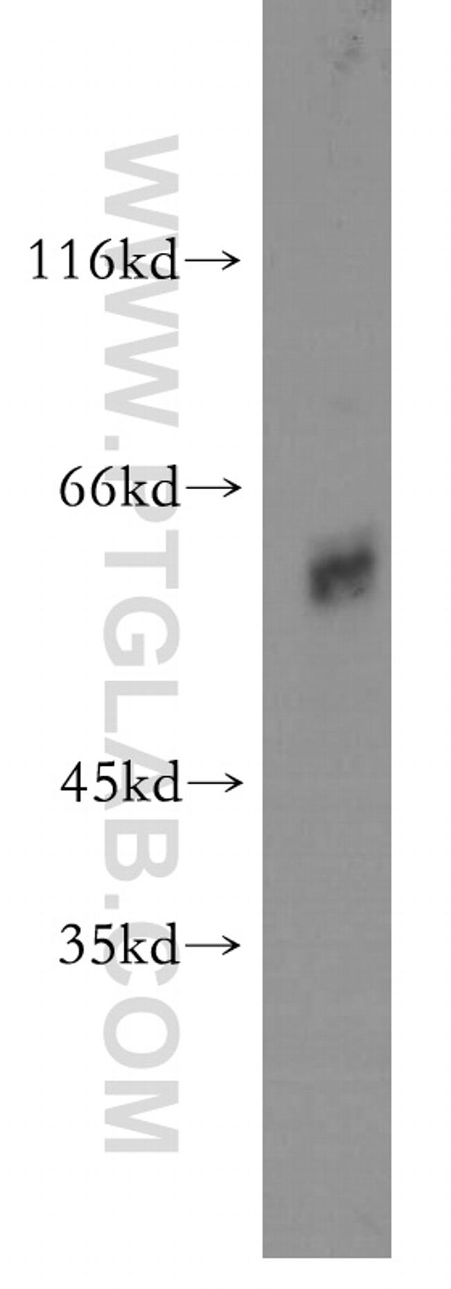 TDG Antibody in Western Blot (WB)