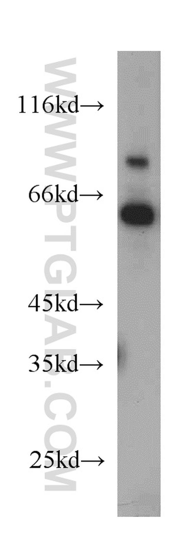 TDG Antibody in Western Blot (WB)