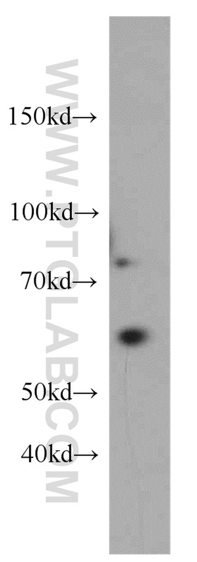 TDG Antibody in Western Blot (WB)