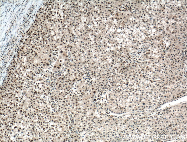 PARP1 Antibody in Immunohistochemistry (Paraffin) (IHC (P))