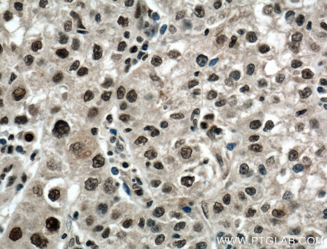 PARP1 Antibody in Immunohistochemistry (Paraffin) (IHC (P))