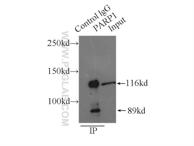 PARP1 Antibody in Immunoprecipitation (IP)